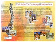 Frida Kahlo: The Dichotomy of Health and Art